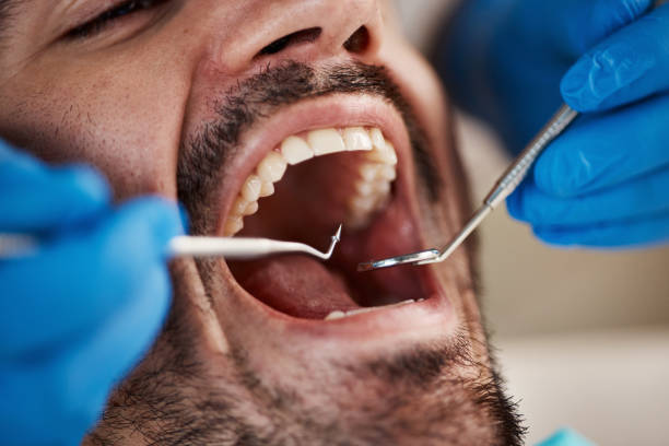 Best Urgent Tooth Repair  in Wadsworth, IL